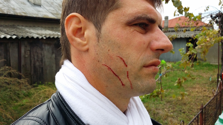 Alexandru Constantin, bărbatul bătut de un polițist din Tulcea